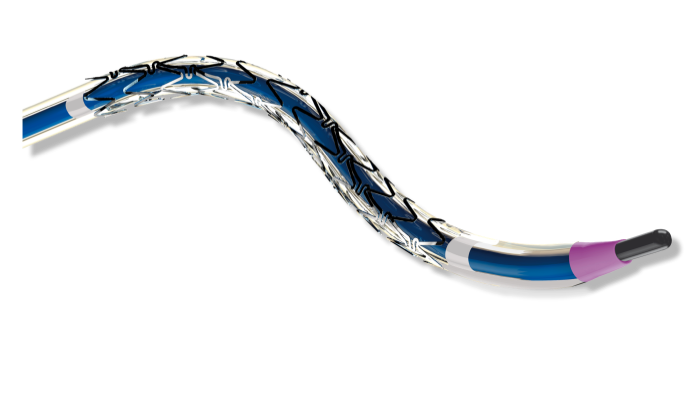 Neurovascular Stent